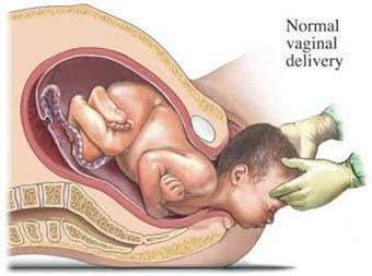 الولادة الطبيعية والولادة القيصرية.. أيهما الأفضل؟
