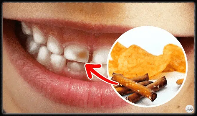 أطعمة ذات تأثير مرعب على الأسنان