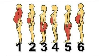 أنواع البدانة المختلفة.. العلاج الأمثل يكشفه سر زيادة وزنك