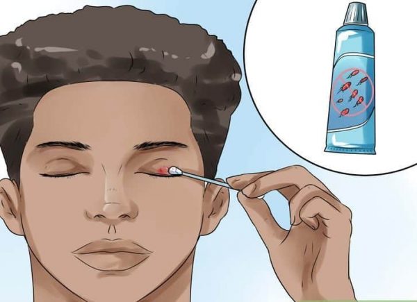 القضاء على دمل العين في 5 خطوات