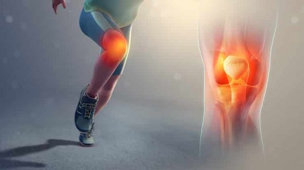 3 طرق طبيعية فعالة لعلاج آلام الركبة 