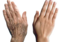 جفاف الجلد.. وأبرز أعراض الشيخوخة