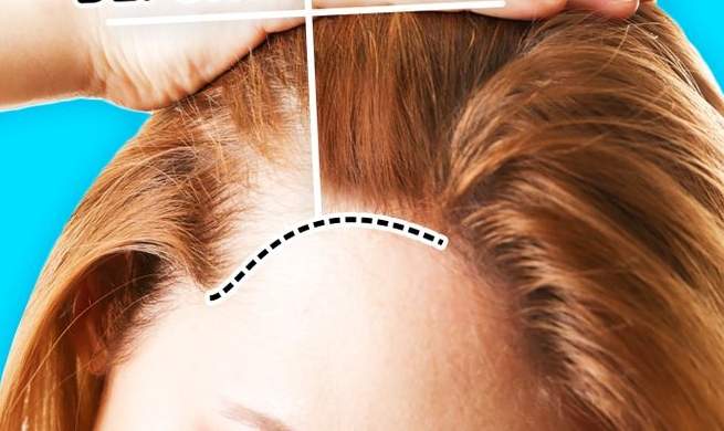 7 اختبارات منزلية تكشف عن تساقط الشعر المفرط