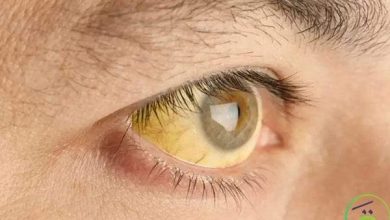 أعراض الاكتئاب على العين.. وهل تكشف عينك إصابتك بالاكتئاب؟