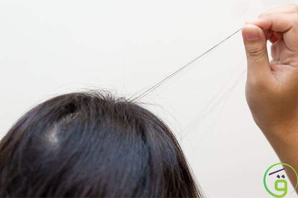 علاج نتف الشعر