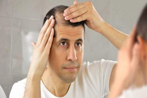 علاج الشعر المتساقط للرجال