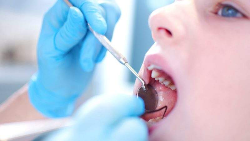 تقرحات الفم.. وأبرز مشاكل الأسنان وعلاجها