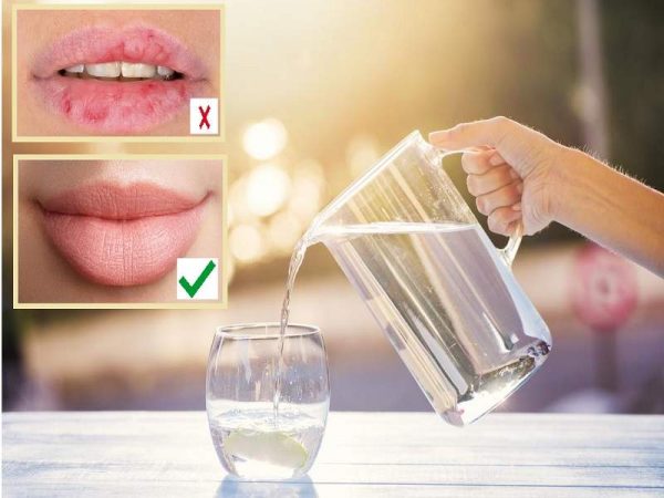 شرب الماء علاج جفاف البشرة