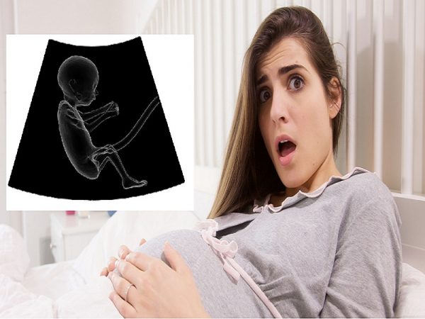 علامات الولادة المبكرة