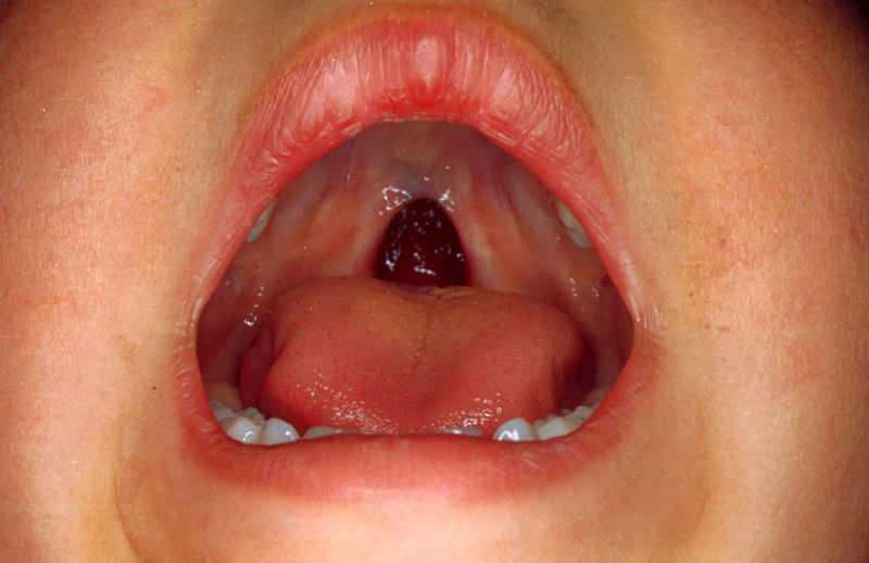 أمراض الفم والأسنان 