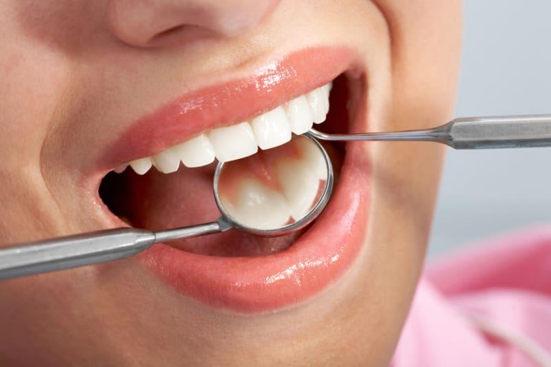 أمراض الفم والأسنان