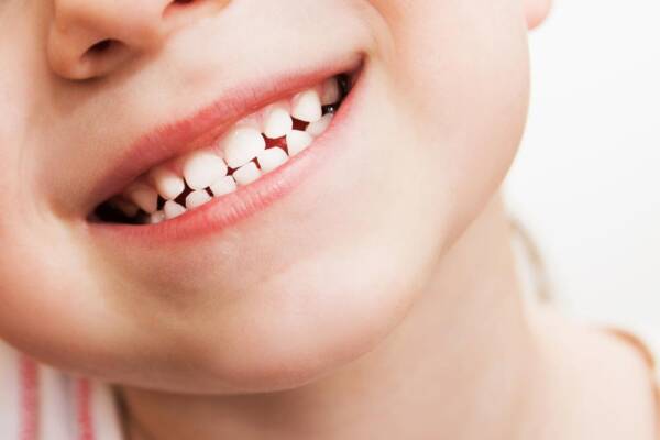 علاج ألم الأسنان عند الأطفال 6 سنوات