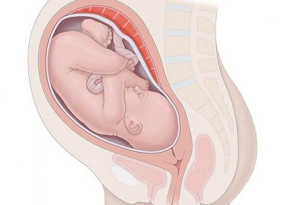 هل زيادة وزن الجنين 4 كيلو خطر على الولادة القيصرية او الطبيعية