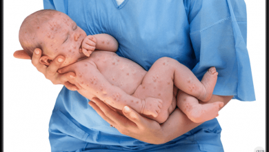 أخطر أمراض الأطفال.. التي اختفت الآن