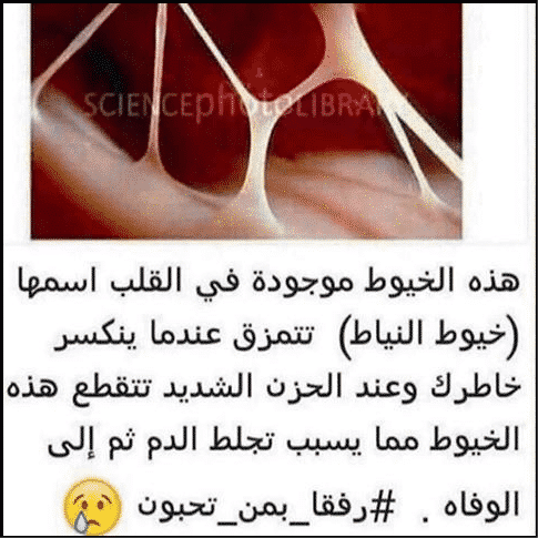 خيوط النياط .. هل تتمزق عند الحزن وتؤدي للوفاة؟ ما هي خيوط النياط بالقلب