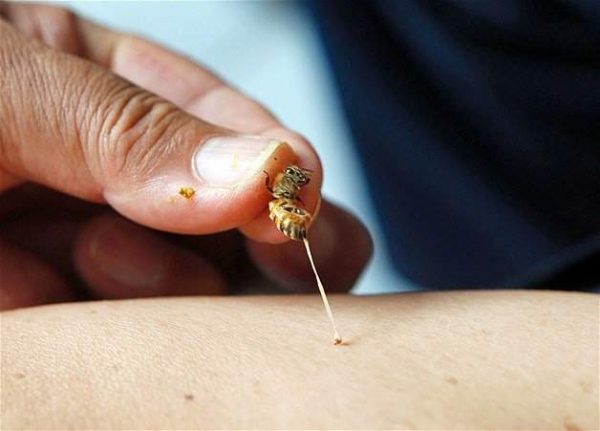 "عجائب" الطب الصيني بين الحقيقة والخرافة