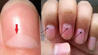 هلال الأظافر.. كيف يفضح الأمراض المستترة؟
