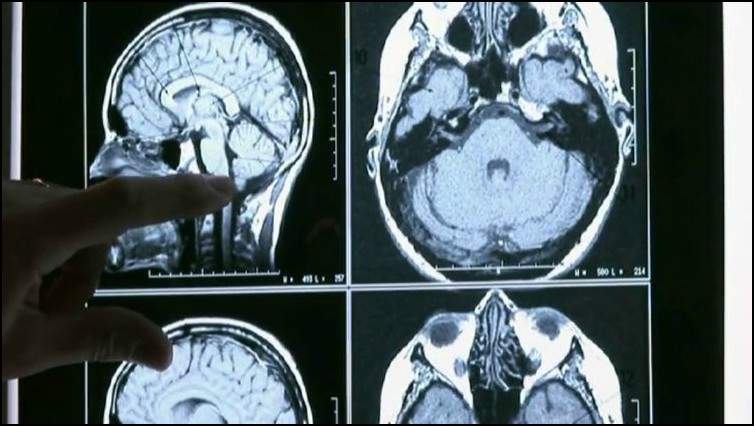 آل أولاس.. الحالة العجيبة لأسرة تسير على أربع!