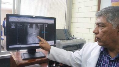 أغرب الأشياء التي اكتشفها الأطباء داخل مرضاهم