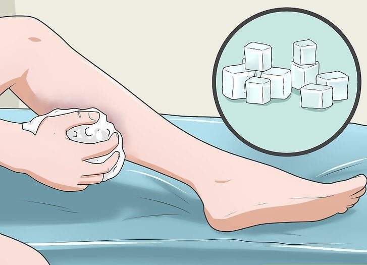 5 نصائح لعلاج الكدمات