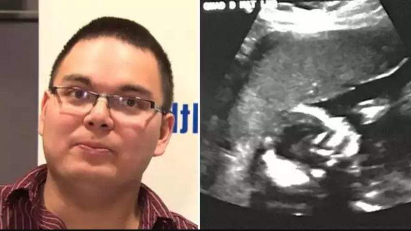 مفاجأة أمام السونار.. لماذا صعق الزوج بعد مشاهدة رحم زوجته؟