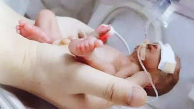 بطل قبل الأوان.. كيف نجا جنين يزن نصف كيلو جرام بمعجزة بعد ولادته المبكرة؟