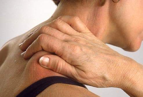 متلازمة التعب المزمن.. الأعراض وطرق العلاج