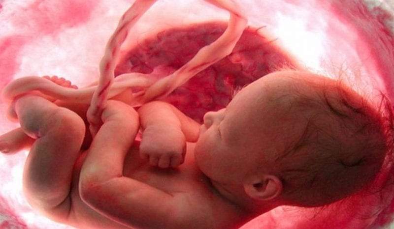 اسباب التفاف الحبل السري حول الجنين