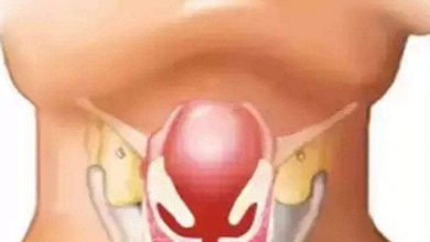 الدفتيريا.. مرض الخناق الذي يصيب الكبار والصغار