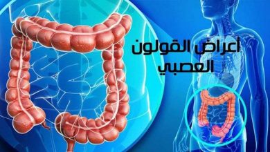 أعراض القولون العصبي