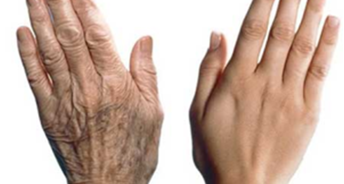 جفاف الجلد.. وأبرز أعراض الشيخوخة