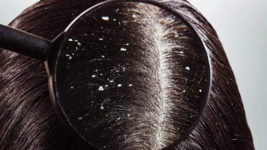 طرق التخلص من القشرة بأفضل الوسائل الطبيعية