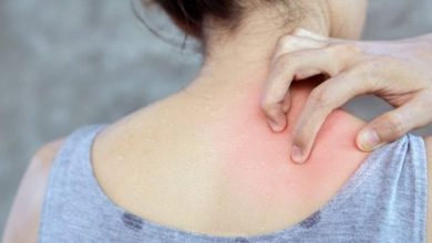 بيروكسيد الهيدروجين.. فوائد شائعة تحيطها الأضرار من كل جانب