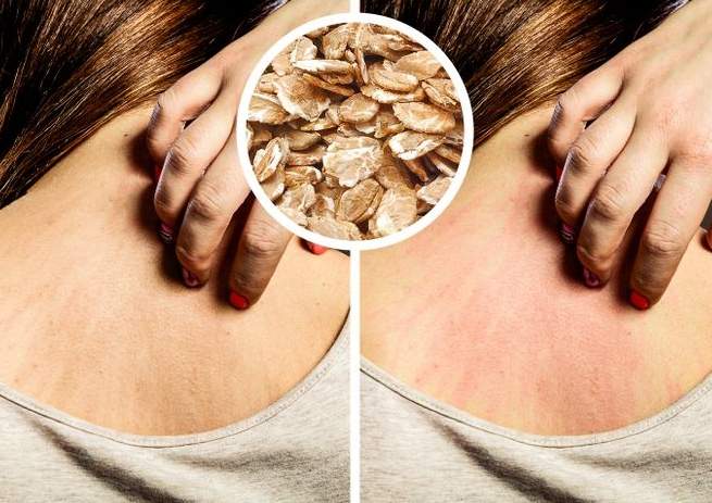 ماذا يحدث عند الإفراط في استخدام المنتجات الطبيعية للعناية بالجمال؟