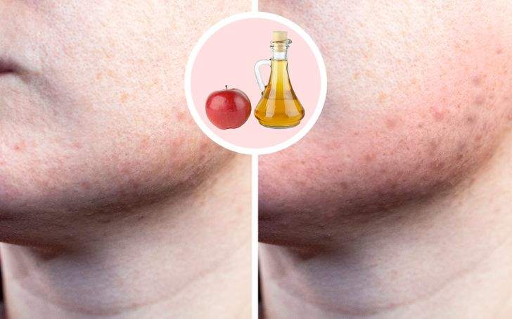 ماذا يحدث عند الإفراط في استخدام المنتجات الطبيعية للعناية بالجمال؟