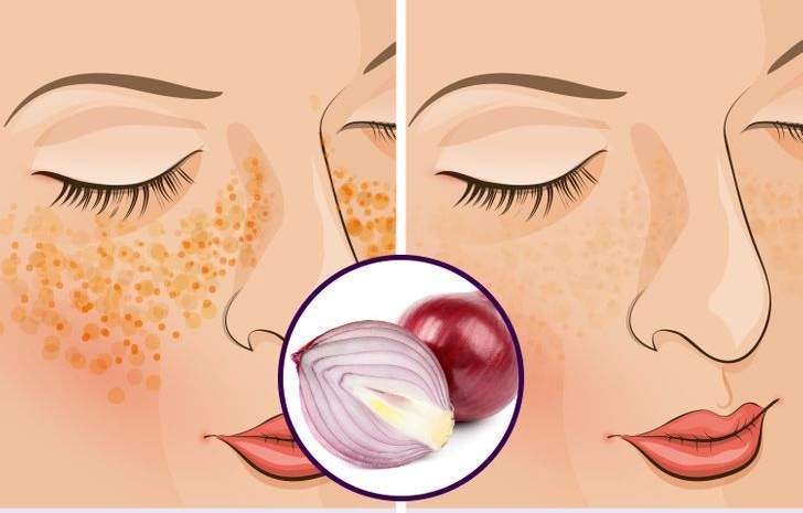 7 طرق طبيعية لمواجهة تصبغ الوجه المزعج