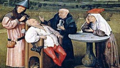 «تربنة الجمجمة».. وهل ثقب القدماء رؤوسهم طواعية؟