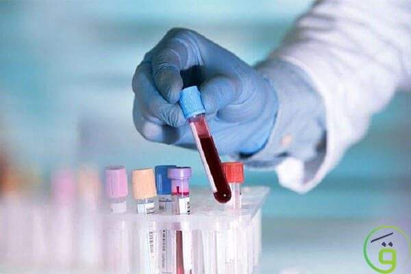 طرق اجراء اختبار الوسواس القهري