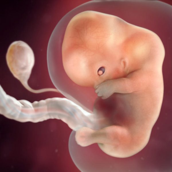 أعراض الحمل خارج الرحم