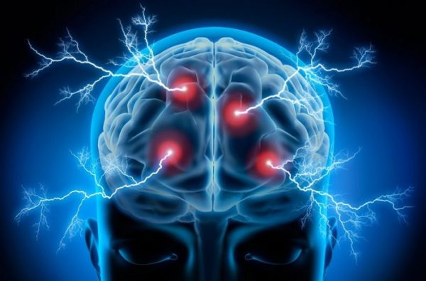 أسباب الكهرباء في المخ 