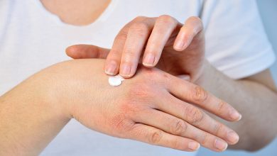 علاج مرض الصدفية