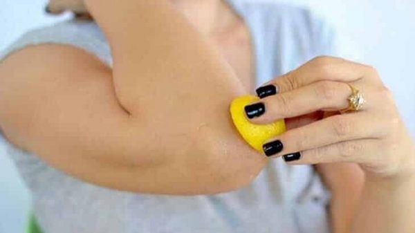 افضل 10 أنواع كريم تفتيح الركب من الصيدلية التخلص من اسمرار الركب والكوع