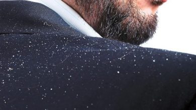 علاج القشرة في الشعر من أول مرة