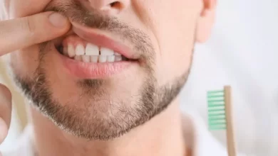 مسكن سريع لالتهاب اللثة
